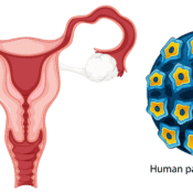 Human Papillomavirus