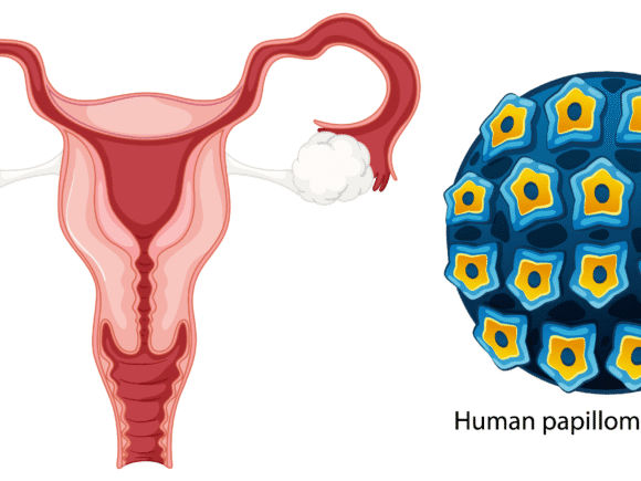 The Triple Threat to Women’s Health: HPV, Menstrual Health Challenges, and Period Poverty