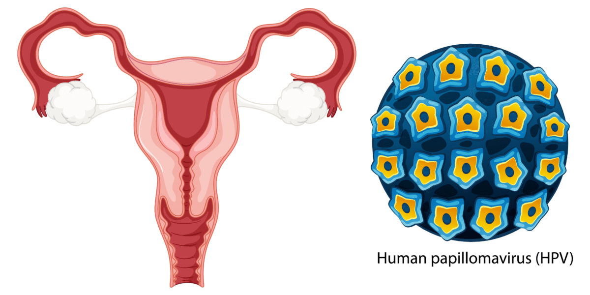 Human Papillomavirus